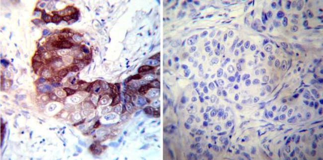 CRABP1 Antibody in Immunohistochemistry (Paraffin) (IHC (P))