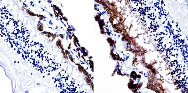 S-arrestin Antibody in Immunohistochemistry (IHC)