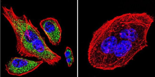 SERCA2 ATPase Antibody in Immunocytochemistry (ICC/IF)