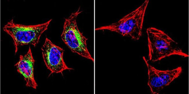 SERCA2 ATPase Antibody in Immunocytochemistry (ICC/IF)