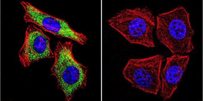 SERCA2 ATPase Antibody in Immunocytochemistry (ICC/IF)