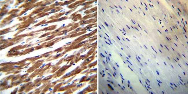 SERCA2 ATPase Antibody in Immunohistochemistry (Paraffin) (IHC (P))