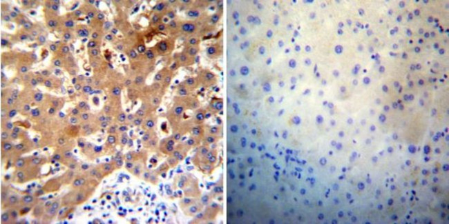 SERCA2 ATPase Antibody in Immunohistochemistry (Paraffin) (IHC (P))