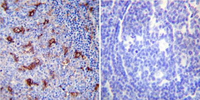 SERCA2 ATPase Antibody in Immunohistochemistry (Paraffin) (IHC (P))