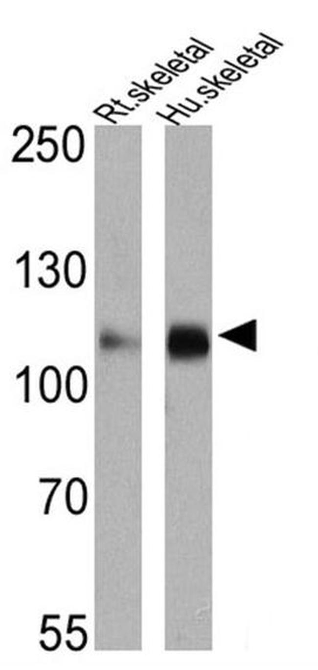 SERCA2 ATPase Antibody in Western Blot (WB)