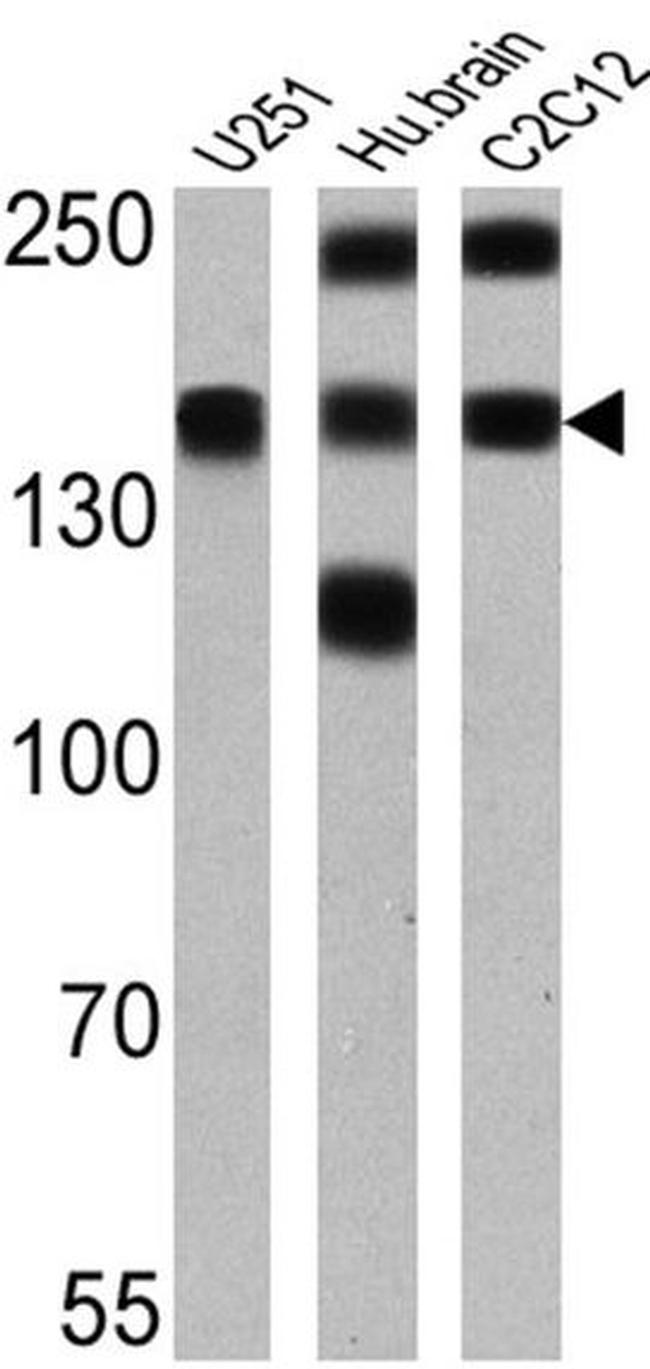 PMCA ATPase Antibody in Western Blot (WB)