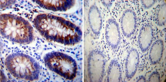 ATP1A3 Antibody in Immunohistochemistry (Paraffin) (IHC (P))