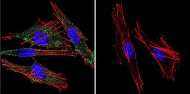 Calmodulin Antibody in Immunocytochemistry (ICC/IF)