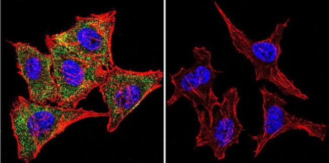 Calmodulin Antibody in Immunocytochemistry (ICC/IF)