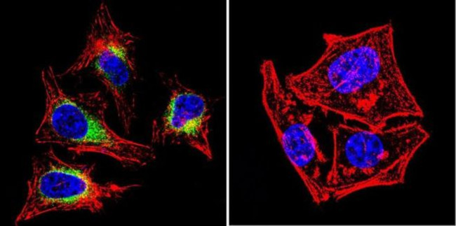 SERCA2 ATPase Antibody in Immunocytochemistry (ICC/IF)