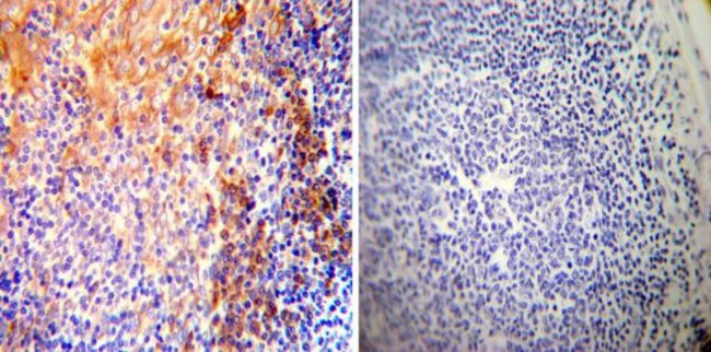 SERCA2 ATPase Antibody in Immunohistochemistry (Paraffin) (IHC (P))