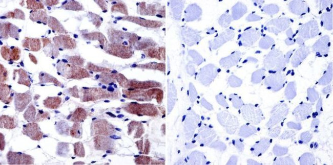 CaV1.1 Antibody in Immunohistochemistry (Paraffin) (IHC (P))