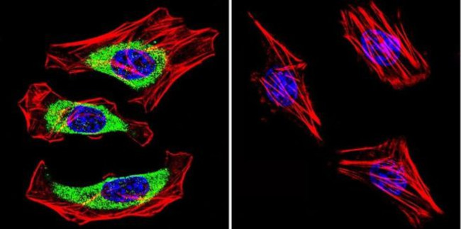 CACNA2D1 Antibody in Immunocytochemistry (ICC/IF)