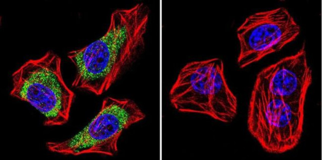 CACNA2D1 Antibody in Immunocytochemistry (ICC/IF)