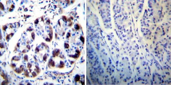 ATP4B Antibody in Immunohistochemistry (Paraffin) (IHC (P))