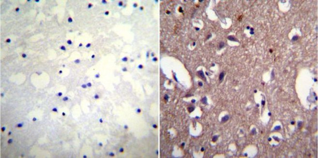 ATP1A1 Antibody in Immunohistochemistry (IHC)