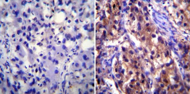 ATP1A1 Antibody in Immunohistochemistry (IHC)