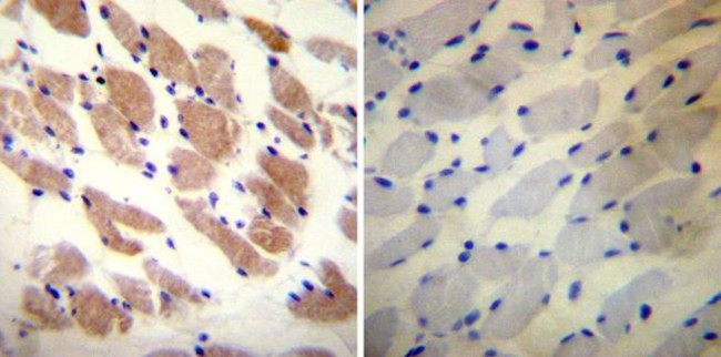 RyR1 Antibody in Immunohistochemistry (Paraffin) (IHC (P))