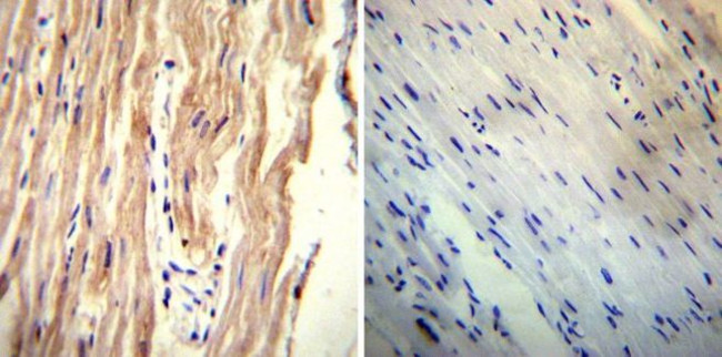 Sodium/Calcium Exchanger Antibody in Immunohistochemistry (Paraffin) (IHC (P))