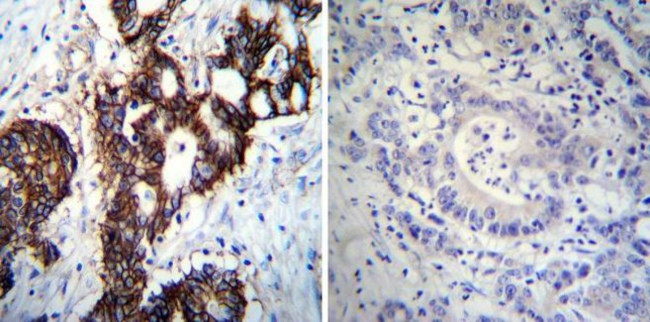 ATP1A1 Antibody in Immunohistochemistry (Paraffin) (IHC (P))