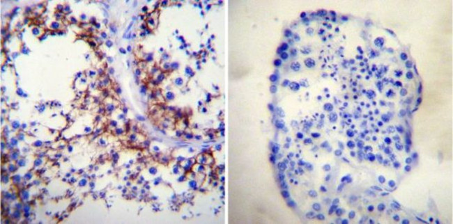 ATP1A1 Antibody in Immunohistochemistry (Paraffin) (IHC (P))