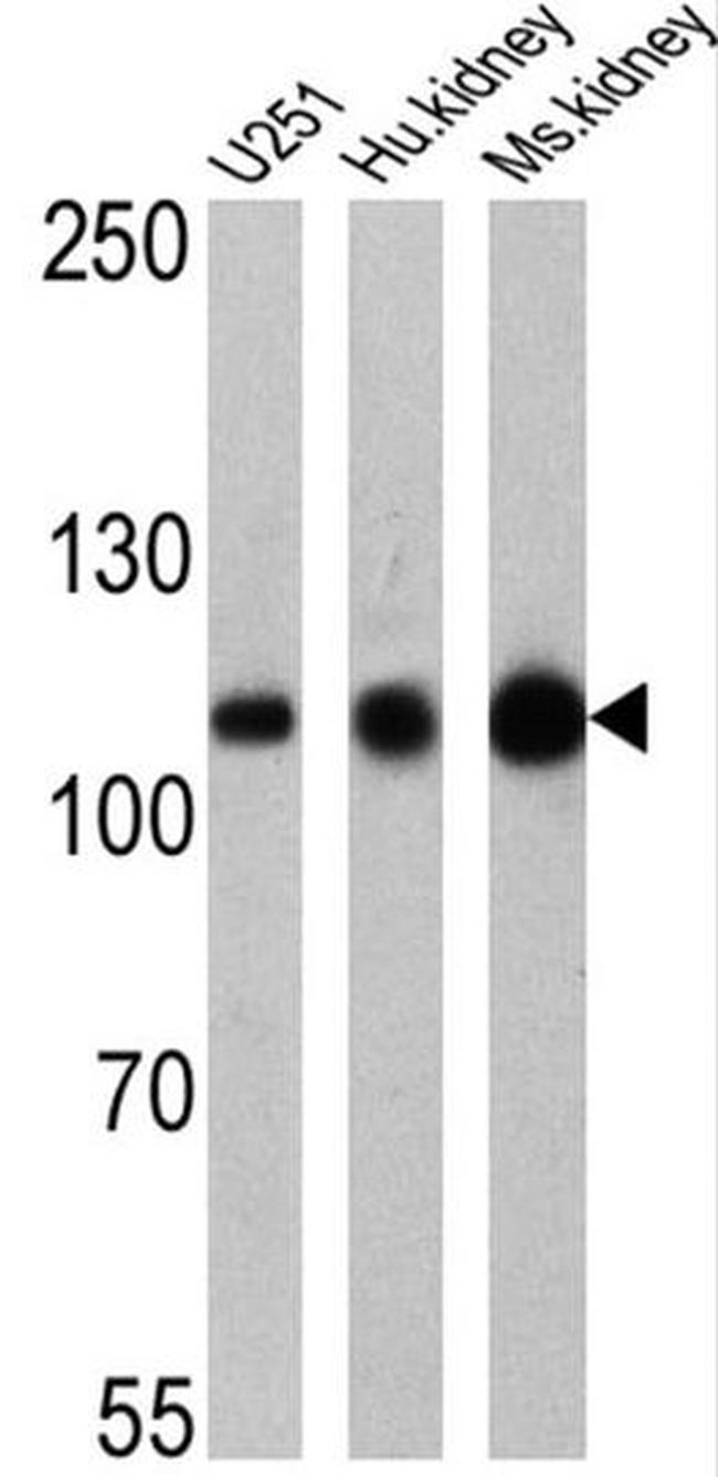 ATP1A1 Antibody in Western Blot (WB)