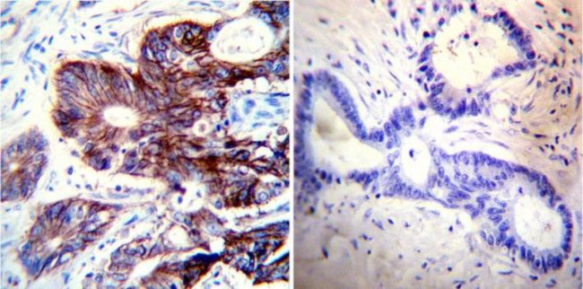 ATP1A1 Antibody in Immunohistochemistry (Paraffin) (IHC (P))