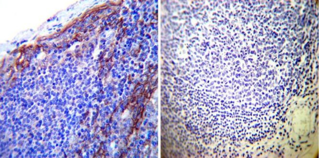 ATP1B1 Antibody in Immunohistochemistry (Paraffin) (IHC (P))