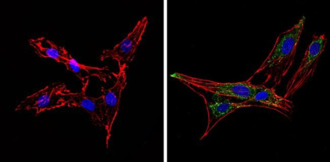 Synaptojanin 1 Antibody in Immunocytochemistry (ICC/IF)