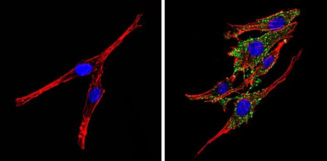 Synaptojanin 1 Antibody in Immunocytochemistry (ICC/IF)