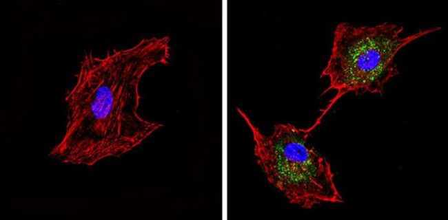 Synaptojanin 1 Antibody in Immunocytochemistry (ICC/IF)