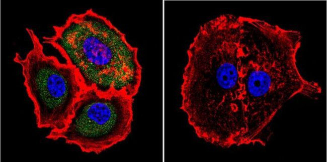 Calpain 2 Antibody in Immunocytochemistry (ICC/IF)