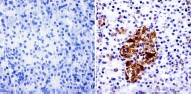 PARP1 Antibody in Immunohistochemistry (Paraffin) (IHC (P))