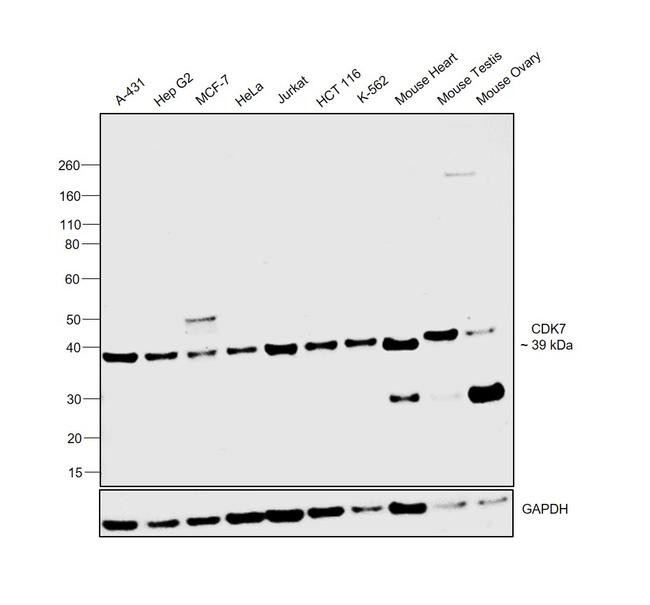 CDK7 Antibody in Western Blot (WB)