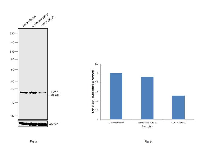 CDK7 Antibody in Western Blot (WB)