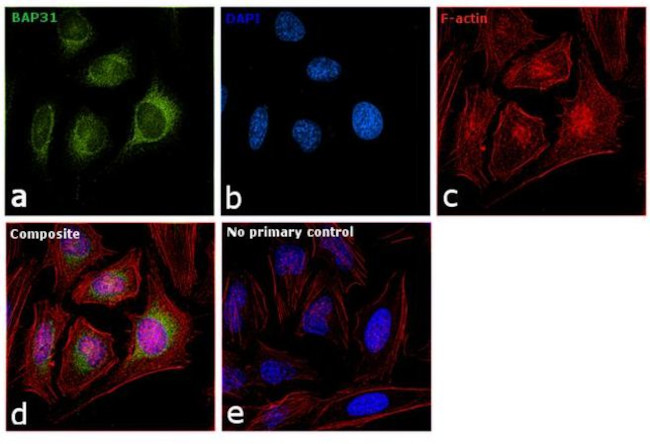 BAP31 Antibody in Immunocytochemistry (ICC/IF)