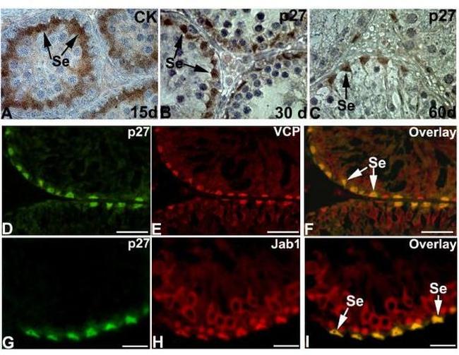 VCP Antibody in Immunohistochemistry (IHC)