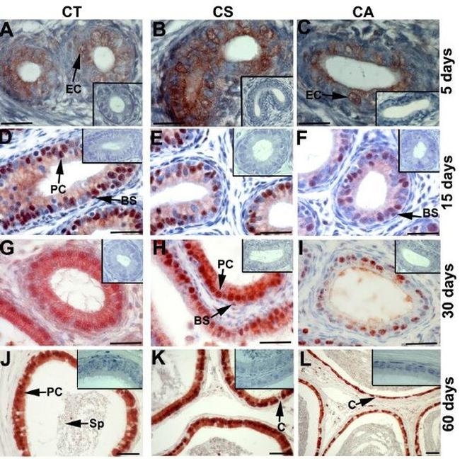 VCP Antibody in Immunohistochemistry (IHC)