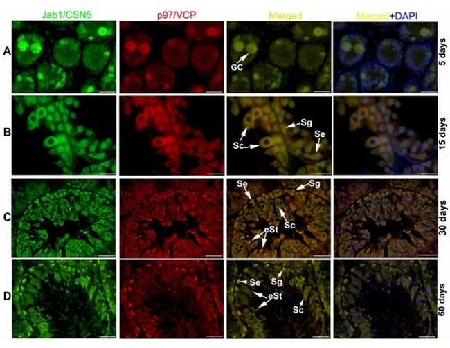 VCP Antibody in Immunohistochemistry (IHC)