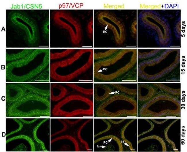 VCP Antibody in Immunohistochemistry (IHC)