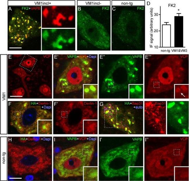 VCP Antibody in Immunocytochemistry (ICC/IF)