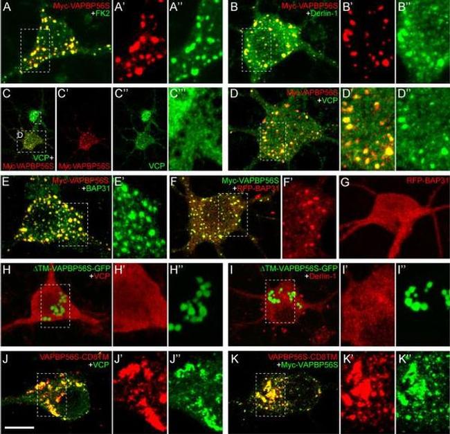 VCP Antibody in Immunocytochemistry (ICC/IF)