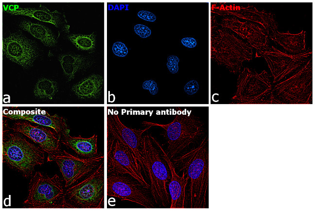 VCP Antibody in Immunocytochemistry (ICC/IF)