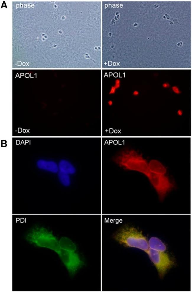 PDI Antibody in Immunocytochemistry (ICC/IF)