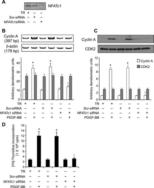 NFATC1 Antibody in Western Blot (WB)