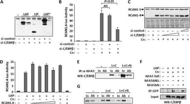 NFATC1 Antibody in Immunoprecipitation (IP)