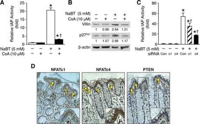 NFATC4 Antibody in Immunohistochemistry (IHC)