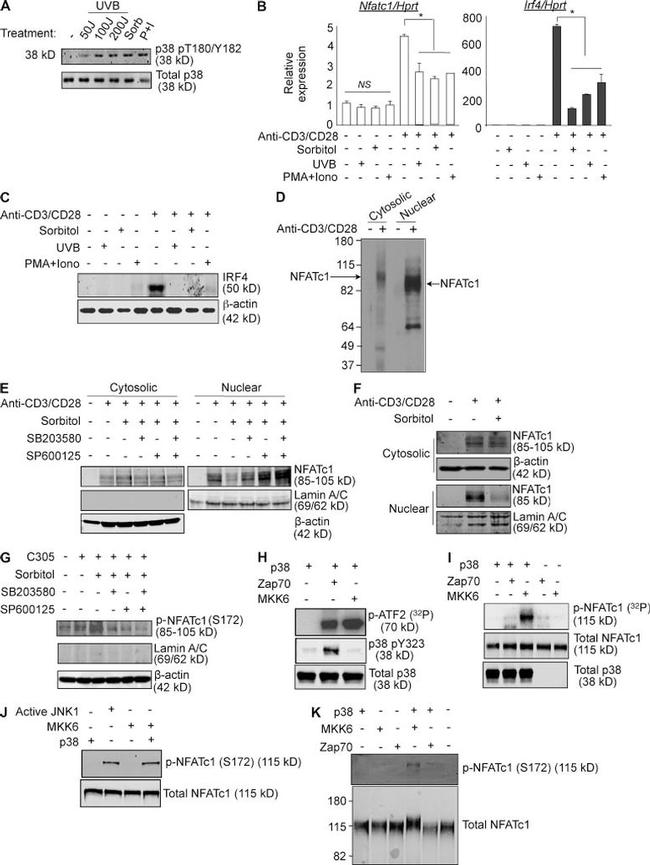 NFATC1 Antibody in Western Blot (WB)