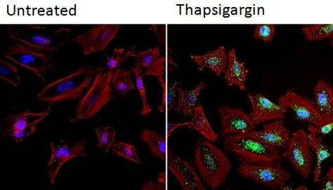 NFATC2 Antibody in Immunocytochemistry (ICC/IF)