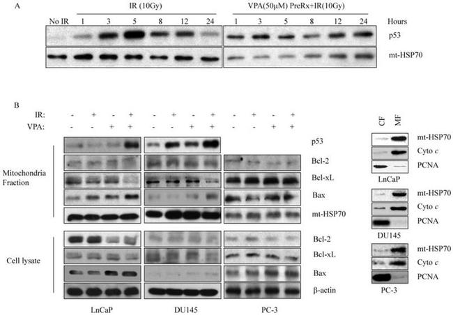 mtHSP70 Antibody in Western Blot (WB)